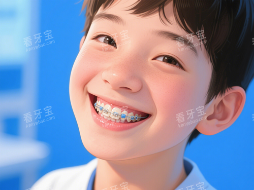 儿童金属牙套矫正.png 儿童金属牙套矫正.png