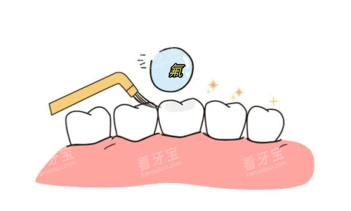 儿童牙齿涂氟动画展示图.png 儿童牙齿涂氟动画展示图.png