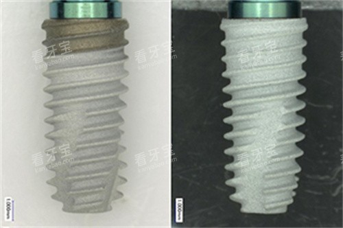 奥齿泰TS3植体实物.jpg 奥齿泰TS3植体实物.jpg