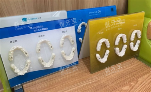 太原美佳口腔正畸模型展示.png 太原美佳口腔正畸模型展示.png