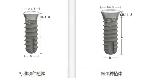 zdi种植体植牙如何.jpg zdi种植体植牙如何.jpg
