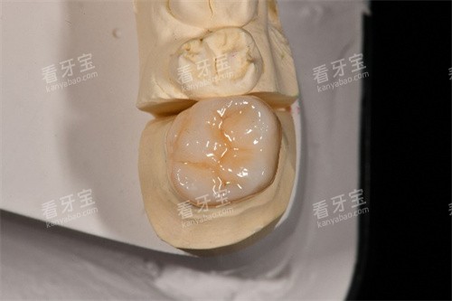 西诺德全瓷牙咬合面展示.jpg 西诺德全瓷牙咬合面展示.jpg