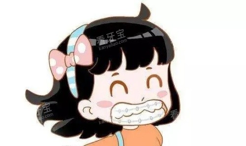 儿童金属矫正示意图.jpg 儿童金属矫正示意图.jpg