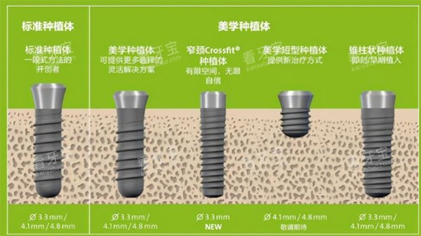 种植体规格种类参考图.jpg 种植体规格种类参考图.jpg