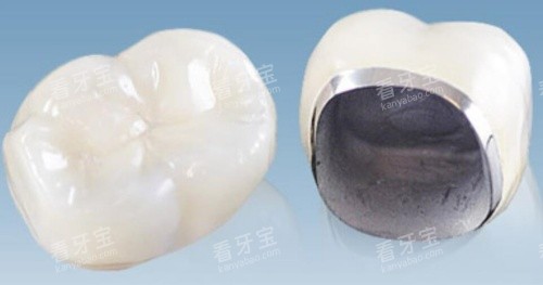 爱迪特全瓷牙.jpg 爱迪特全瓷牙.jpg