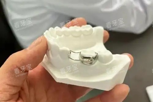 儿童牙齿间隙保持器.jpg 儿童牙齿间隙保持器.jpg