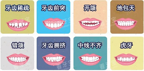 牙齿矫正不同适应症漫画图.jpg 牙齿矫正不同适应症漫画图.jpg