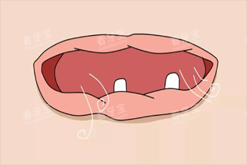牙齿缺失卡通.jpg 牙齿缺失卡通.jpg