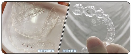 隐形牙套对比照片.jpg 隐形牙套对比照片.jpg