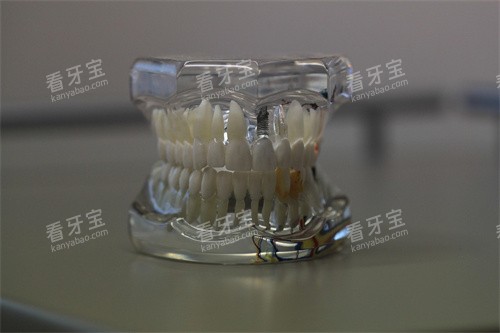 牙齿模型示意图宣传.jpg 牙齿模型示意图宣传.jpg