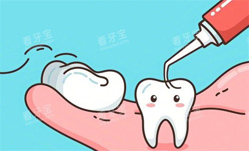 儿童涂氟照片展示.jpg 儿童涂氟照片展示.jpg