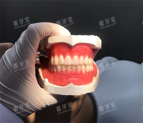 全口义齿模型展示.jpg 全口义齿模型展示.jpg