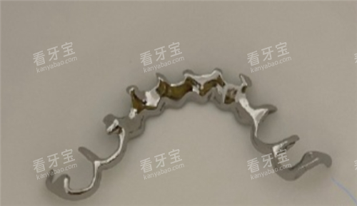 牙周夹板实物图.png 牙周夹板实物图.png