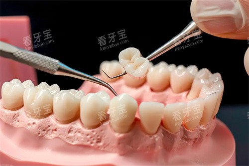 牙齿模型治疗图片.jpg 牙齿模型治疗图片.jpg
