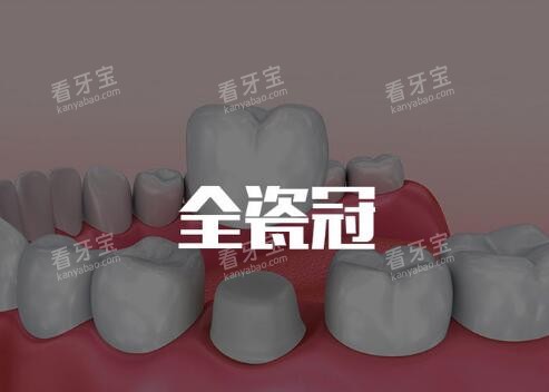全瓷冠修复改善.jpg 全瓷冠修复改善.jpg