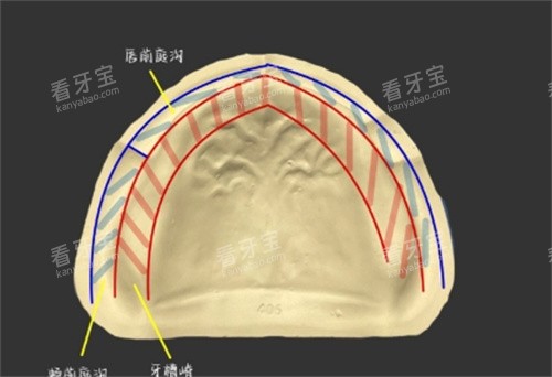 无牙颌细节照片.jpg 无牙颌细节照片.jpg