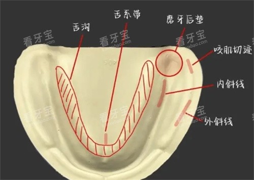 无牙颌动画图.jpg 无牙颌动画图.jpg