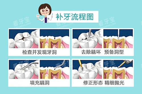 补牙流程图示.jpg 补牙流程图示.jpg