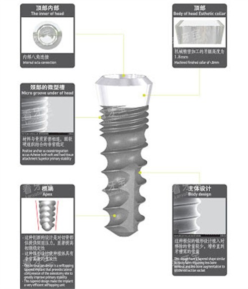 韩国SG种植体详细介绍.jpg 韩国SG种植体详细介绍.jpg
