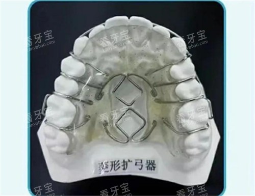 菱形扩弓器怎么样.jpg 菱形扩弓器怎么样.jpg