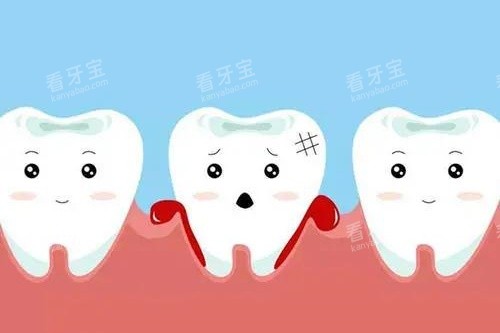 牙龈出血卡通图.jpg 牙龈出血卡通图.jpg