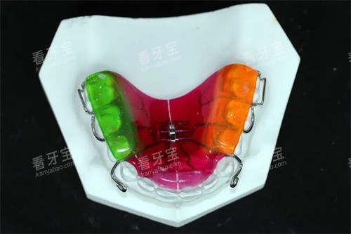口内反颌牵引器.jpg 口内反颌牵引器.jpg