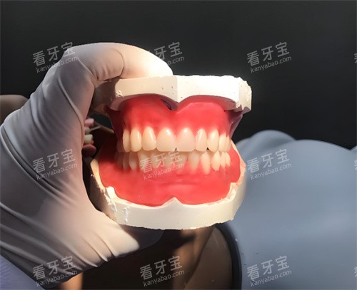 全口义齿模型.jpg 全口义齿模型.jpg