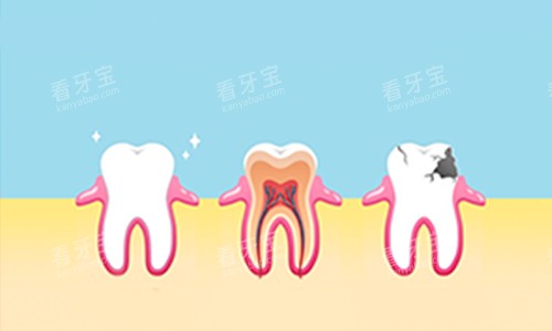蛀牙动画展示图.jpg 蛀牙动画展示图.jpg