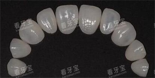 牙贴面修复改善.jpg 牙贴面修复改善.jpg
