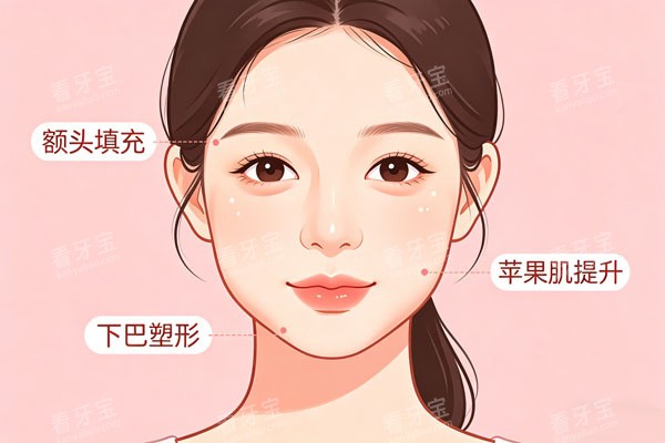 玻尿酸面部提升示意图.jpg 玻尿酸面部提升示意图.jpg