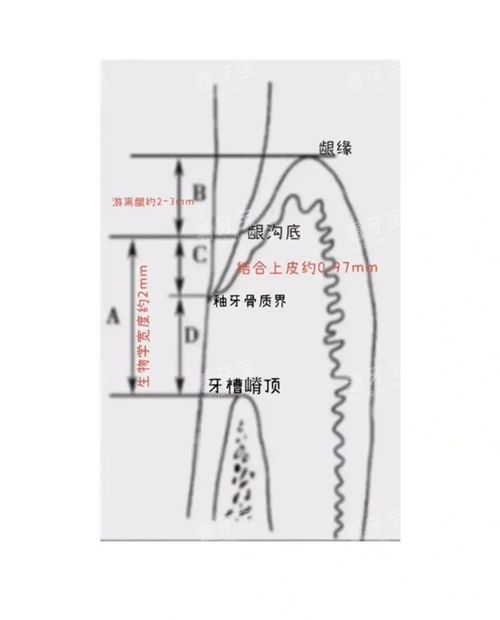 牙齿龈嵴顶位置.webp.png 牙齿龈嵴顶位置.webp.png