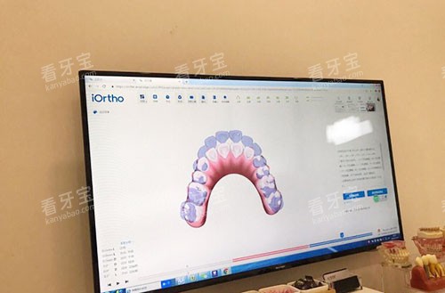 温州爱牙故事口腔牙齿矫正方案设计.jpg 温州爱牙故事口腔牙齿矫正方案设计.jpg