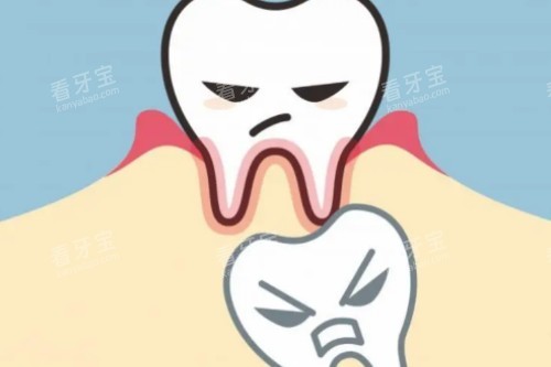 小孩子乳牙滞留图片展示.jpg 小孩子乳牙滞留图片展示.jpg