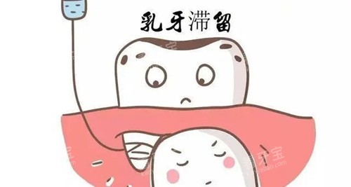 乳牙滞留坏处.jpg 乳牙滞留坏处.jpg