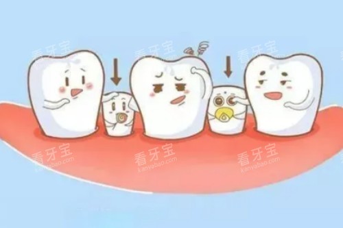 小孩子乳牙滞留卡通图.jpg 小孩子乳牙滞留卡通图.jpg