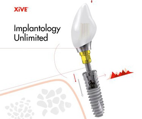 xive��ֲ������.jpg